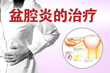 盆腔炎是什么病癥?盆腔炎治療方法及預防措施 盆腔炎是什么病癥?盆腔炎治療方法及預防措施