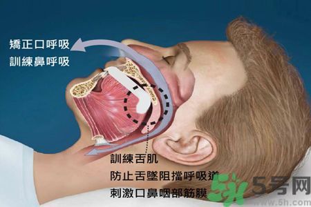 耳鳴是什么原因引起的？耳鳴怎么治療最好？