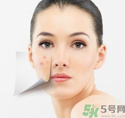 臉上有斑怎么去除？祛斑的小偏方有哪些？