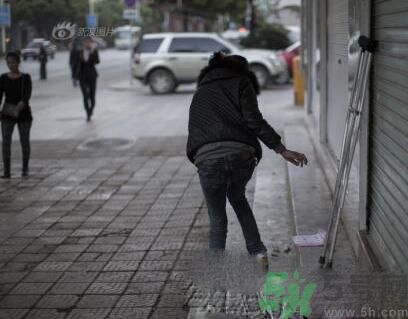 學(xué)生患東方美女病是怎么回事？東方美女病是什么病？