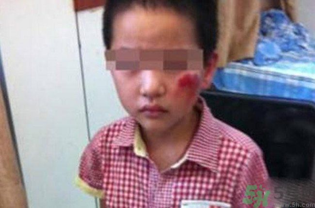 男孩遭校長暴打的結(jié)果是什么？男孩遭校長暴打的真相是什么？
