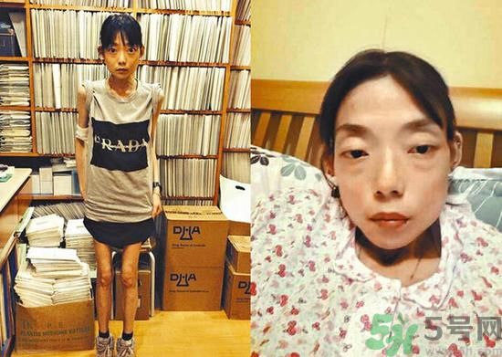 富二代離婚娶二線女星前妻瘦成骷髏  怎么選擇有責任的男人？
