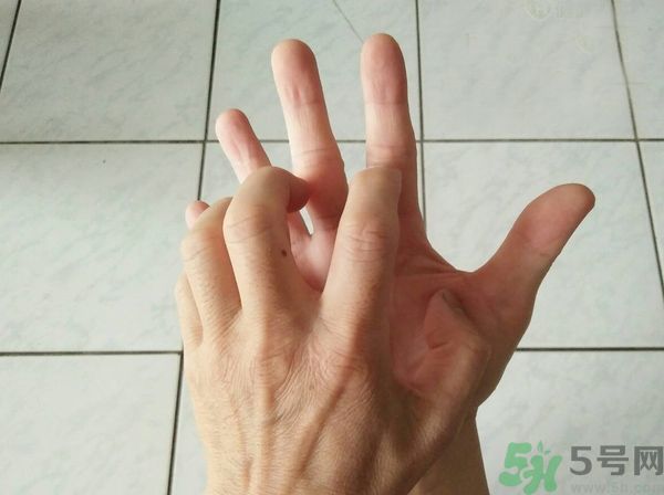 手上起水泡是什么原因？怎樣預(yù)防手上起水泡？