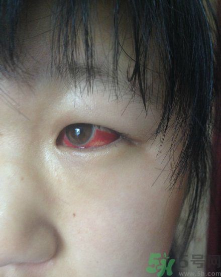 初中生全體甲醛中毒是怎么回事？初中生全體甲醛中毒是哪個學(xué)校？