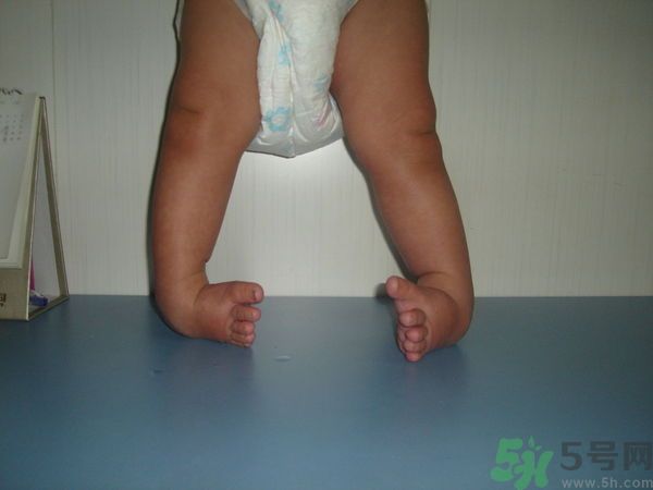 女生3天花8萬(wàn)是怎么回事？馬蹄足是什么病？