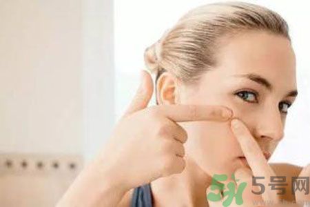 一到夏天呢長(zhǎng)痘痘怎么回事？夏天長(zhǎng)痘痘怎么辦？