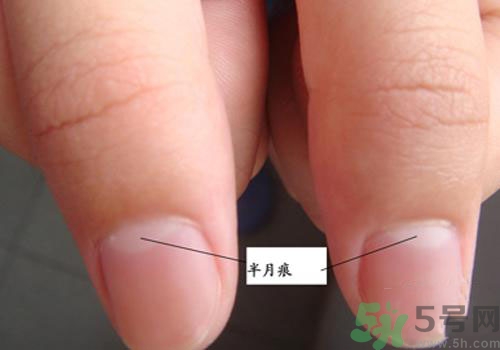指甲沒有月牙是什么原因？指甲沒有月牙怎么調理？