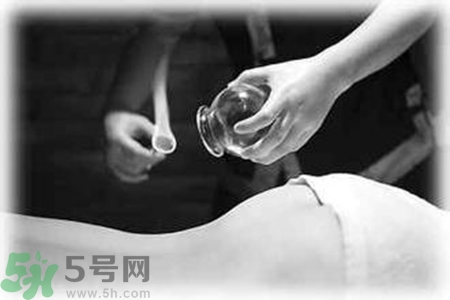 大暑可以拔罐嗎？大暑拔罐好不好？
