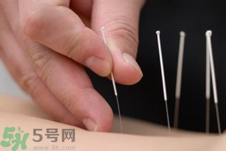 大暑可以針灸嗎？大暑針灸好不好？