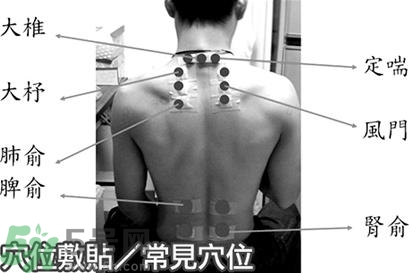 經期可以貼三伏貼嗎？來月經可以貼三伏貼嗎？