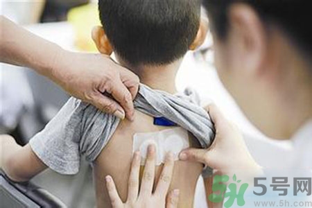 肝炎貼三伏貼有用嗎？肝病貼三伏貼貼哪里？