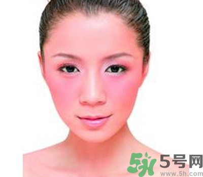 敏感性皮膚用什么洗面奶？敏感性皮膚怎么修復？