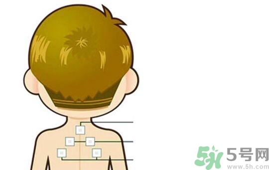 貼三伏貼可以吹空調嗎？貼完三伏貼多久后可以吹空調？