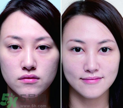臥蠶是什么？臥蠶是眼袋嗎？