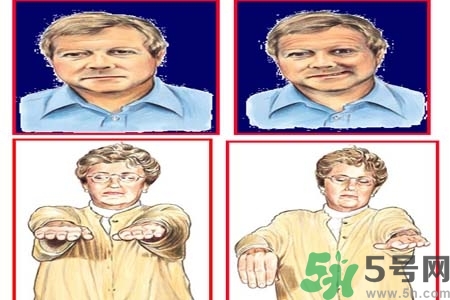 腦中風的發(fā)病因素？腦中風的并發(fā)癥有哪些 ？