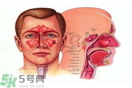 鼻竇炎是什么？鼻竇炎的癥狀有哪些？