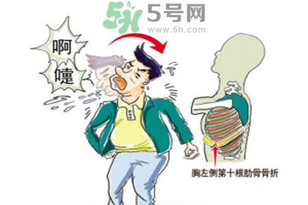 過敏性鼻炎是什么？過敏性鼻炎的癥狀有哪些？