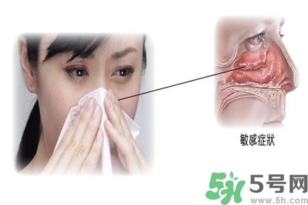 過(guò)敏性鼻炎的高發(fā)人群有哪些？如何預(yù)防過(guò)敏性鼻炎？