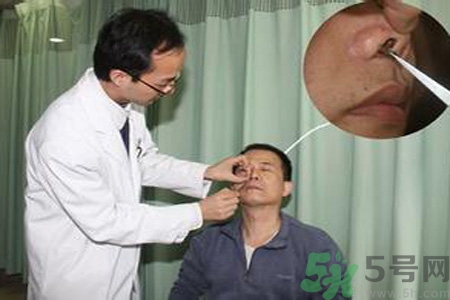 鼻咽癌的治療方法是什么？鼻咽癌可以用什么藥物治療？