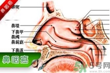 鼻咽癌的發病因素是什么？鼻咽癌的并發癥有哪些？