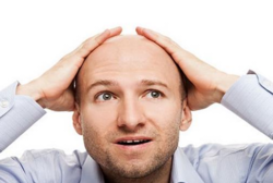 男人禿頂能治好嗎?治療禿頂小偏方 男人禿頂能治好嗎?治療禿頂小偏方