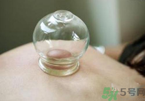 拔火罐和拔氣罐哪個好？拔火罐和拔氣罐的區別