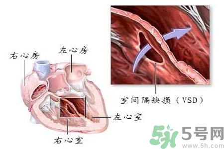 心臟病是怎么形成的？易發(fā)人群有哪些？
