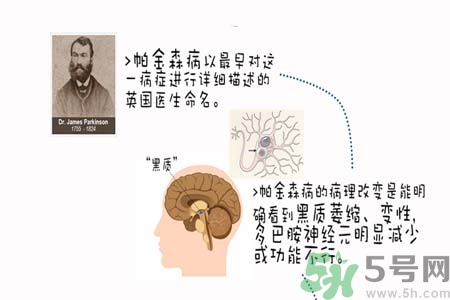 帕金森的治療方法有哪些？