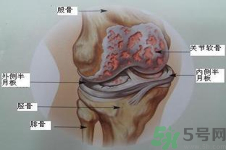 預防骨病需要注意哪些姿勢？秋季預防骨病的方法有哪些？