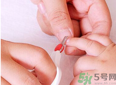 寶寶長(zhǎng)蘚是怎么回事？寶寶長(zhǎng)蘚怎么辦？