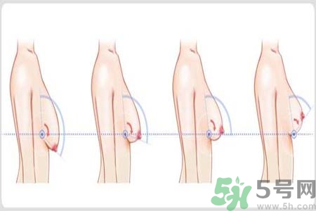 如何預防胸部松弛？吃什么能使胸部挺拔？