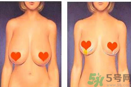 如何預防胸部松弛？吃什么能使胸部挺拔？