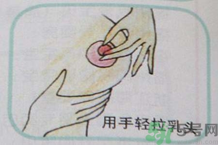 乳頭內(nèi)陷怎么回事？乳頭內(nèi)陷的原因是什么？