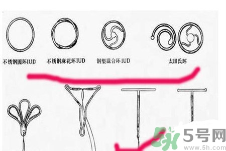 避孕的辦法有什么？避孕的方法有哪些？