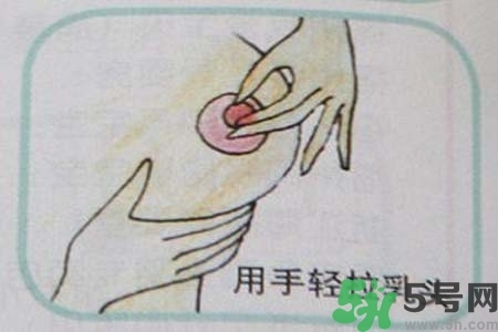 乳頭內(nèi)陷怎么矯正？乳頭內(nèi)陷矯正方法是什么？
