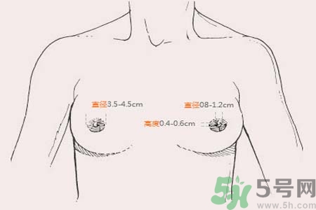乳頭內(nèi)陷能不能喂奶？乳頭凹陷怎樣哺乳？