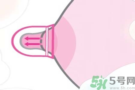乳頭內(nèi)陷可以用吸奶器嗎？乳頭內(nèi)陷能不能用吸奶器？