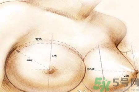 乳頭內(nèi)陷可以用吸奶器嗎？乳頭內(nèi)陷能不能用吸奶器？
