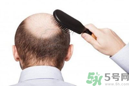 男性更年期的表現有哪些？怎么判斷男性更年期？
