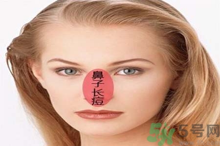 鼻子兩側長痘怎么辦？鼻子兩側長痘怎么回事？