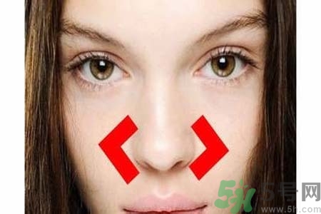 鼻子兩側長痘怎么辦？鼻子兩側長痘怎么回事？