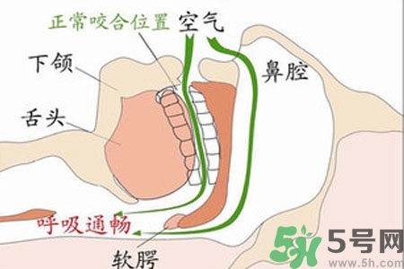 鼻子紅是什么原因？鼻子紅怎么辦？