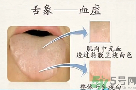 血虛的癥狀是什么？血虛的表現有哪些？