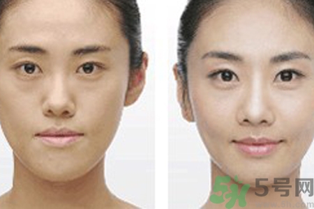 激光縮毛孔多少錢一次？激光縮毛孔一個療程多少錢？
