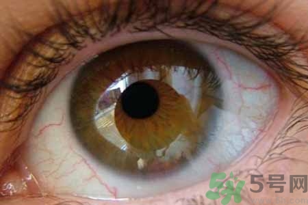 ?干眼癥的治療方法是什么？如何預(yù)防干眼癥？