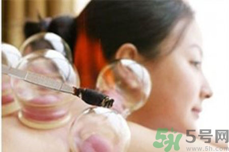 月經(jīng)可以拔火罐嗎？經(jīng)期可以拔火罐嗎？