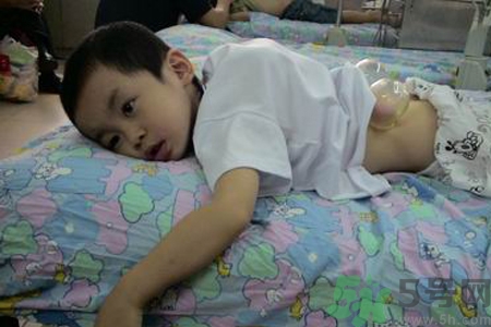 小孩可以拔罐嗎？寶寶能拔火罐嗎？