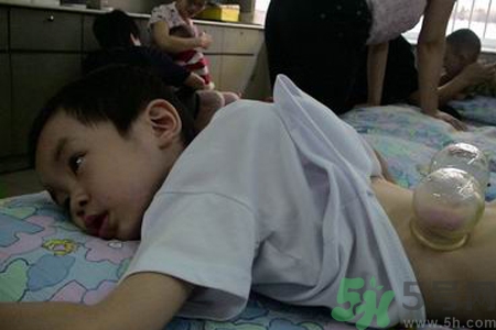 小孩可以拔罐嗎？寶寶能拔火罐嗎？