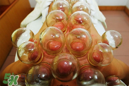 拔罐后皮膚發(fā)癢是怎么回事？拔罐后為什么皮膚會(huì)癢？