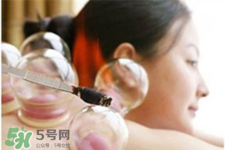 冬天拔罐好嗎？冬季最好不要拔火罐